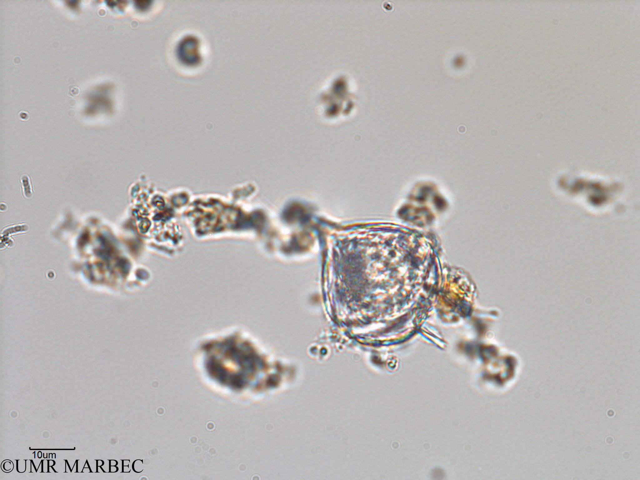 phyto/Bizerte/bizerte_lagoon/RISCO February 2015/Protoperidinium sp31 (ancien Lagune_T1-C-Protoperidinium sp31 -9).tif(copy).jpg